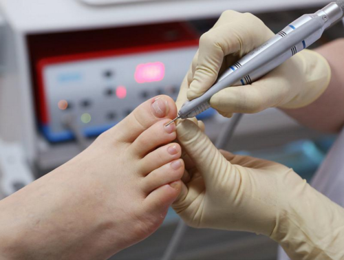 nail treatment