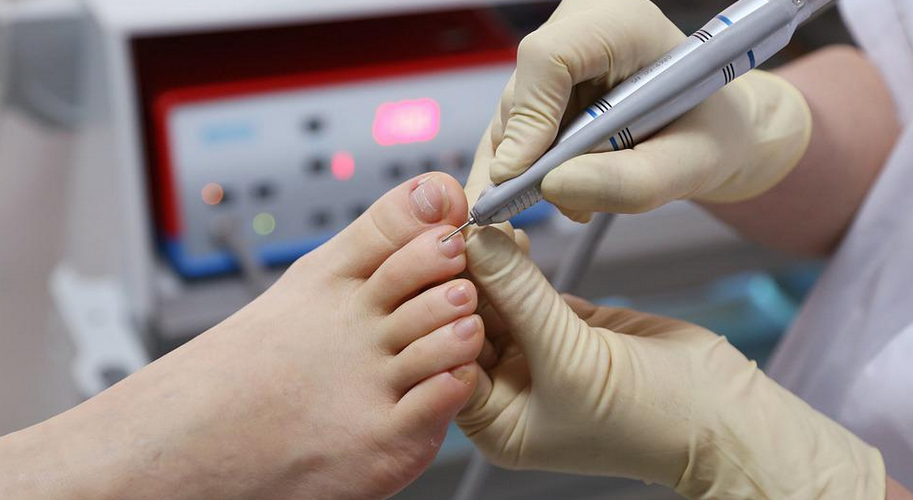 nail treatment